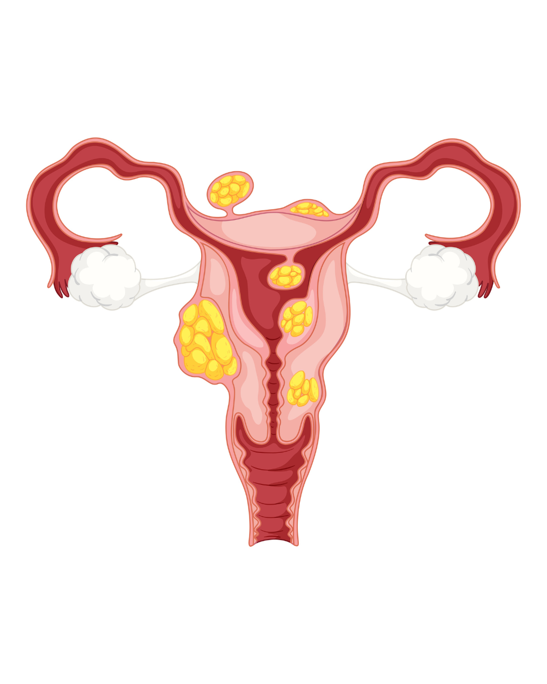 Untitled_design_(6).png