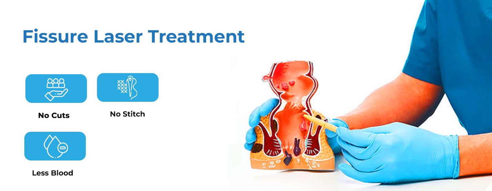 best-laser-treatment-for-fissure-in-hyderabad-anal-fissure