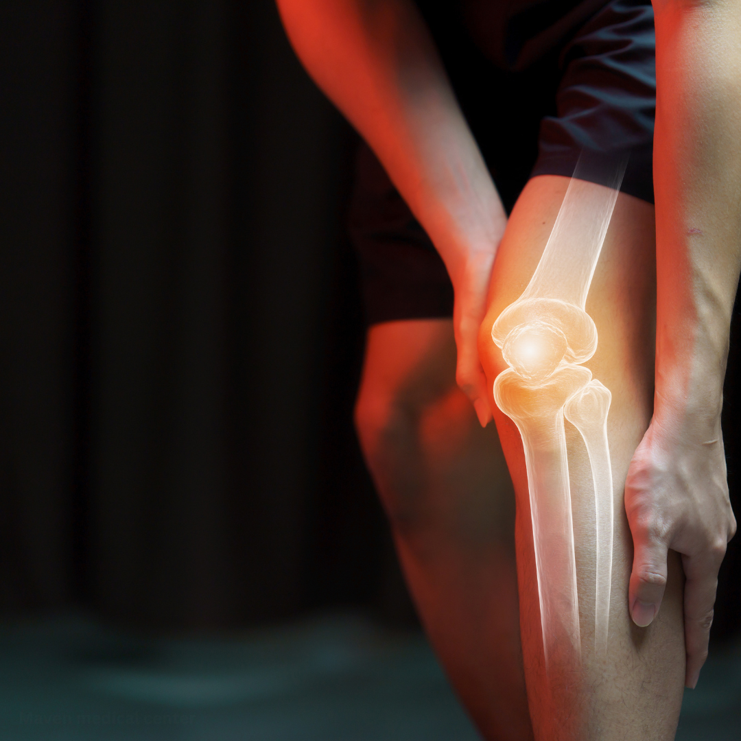 knee3.png